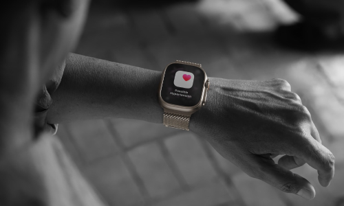 고혈압, 수면 무호흡증, 청각 건강 기능이 추가 국가로 확장됩니다.